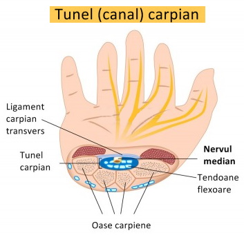 sindrom-tunel-carpian400