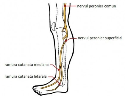 neuropatia-peroniera